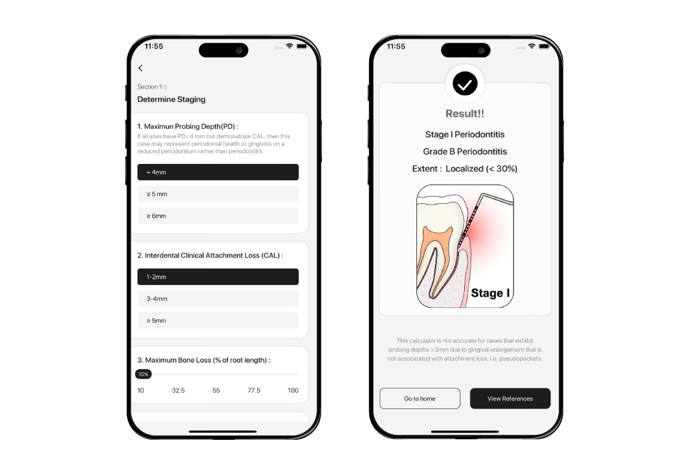 periodontal condition