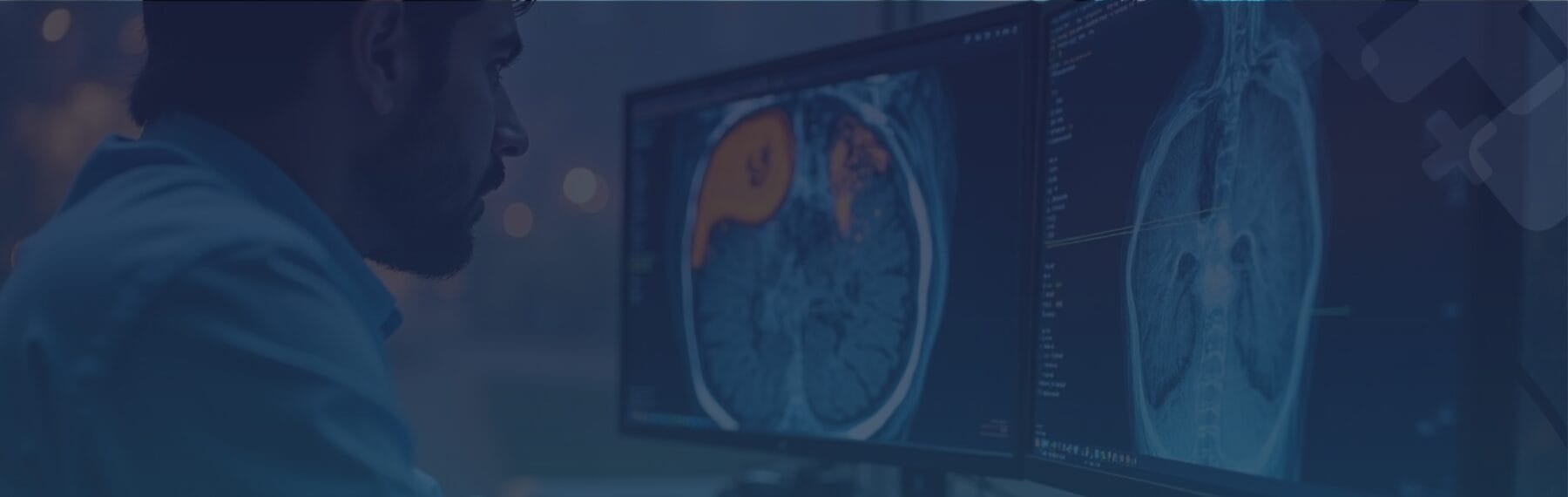 AI in Medical Imaging: How Artificial Intelligence is Redefining the Future of Radiology in 2025
